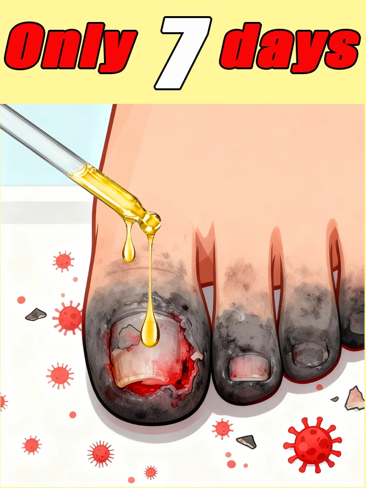 ティーツリーネイルソリューション、デイリーケア、10ml