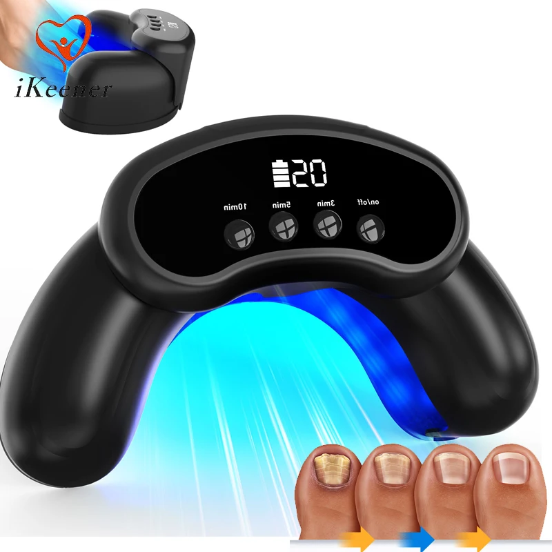 New Nail Fungus Laser Treatment Device 470nm Blue Light 905nm Invisible Infrared Light Dual-Wave Therapy for Onychomycosis