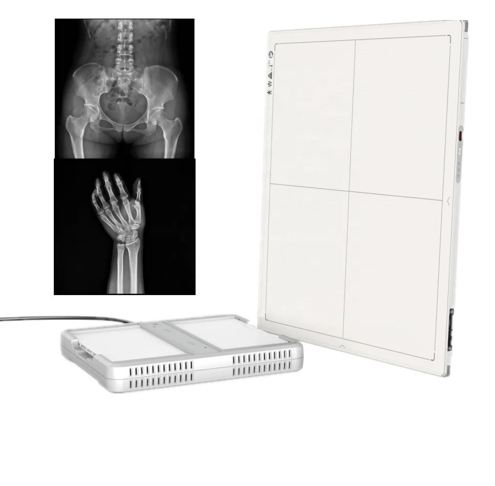 MSLFP03 14*17 Wireless X-ray Detector High-quality  Flat Panel Detector X Ray for Human and Pet