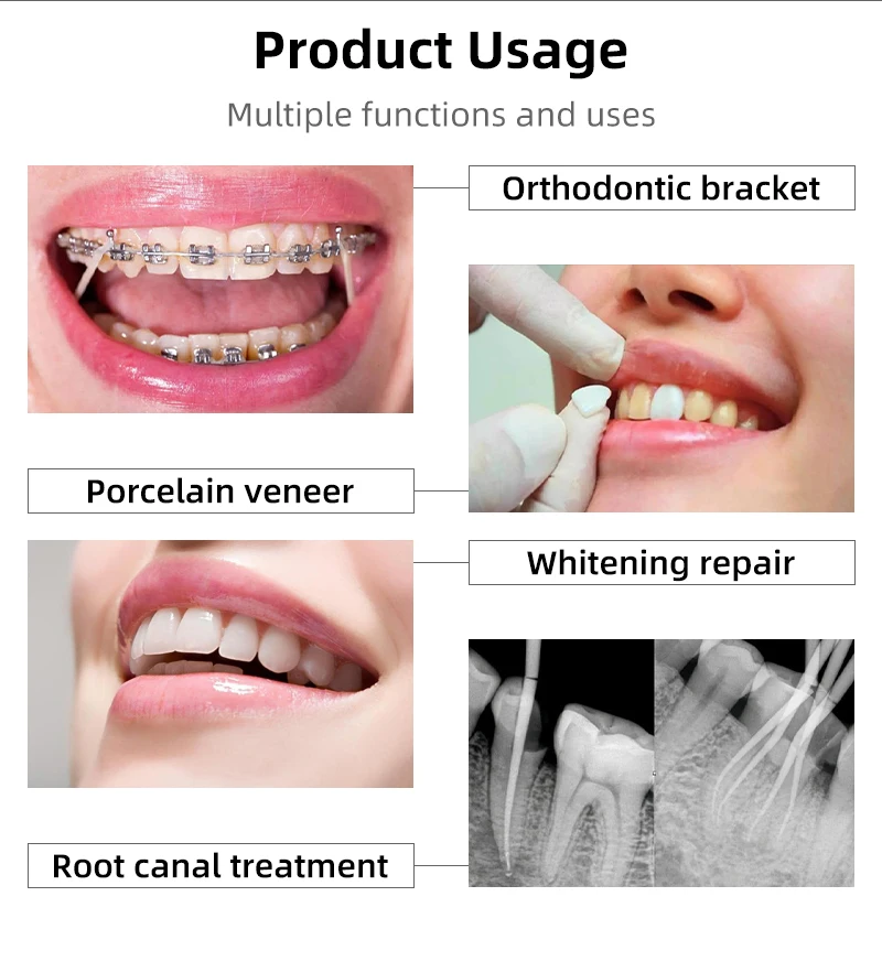 VVDental LED-Aushärtelampe für Zahnmedizin, Dental-Aushärtung für Zahnarztwerkzeuge, Photopolymerisator 3S Gear, Harz-Aushärtungsinstrument – Detail 3