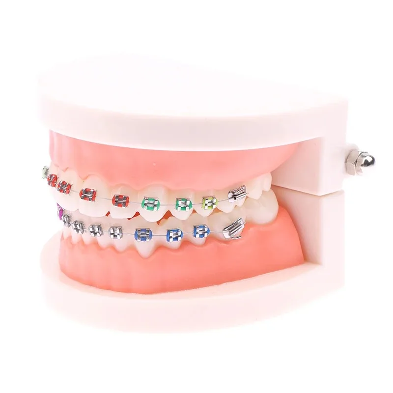 Modelo de tratamiento Dental de ortodoncia, modelo de dientes Typodont para enseñanza, estudio, soportes de Metal/cerámica, lazos de ligadura de alambre de arco, 1 unidad