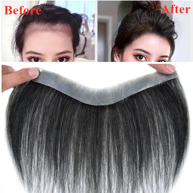 Natural Human Hairline Replacement System Forehead Hair Pieces For Baldness Thin Skin PU With Tapes Non-Remy Brazilian