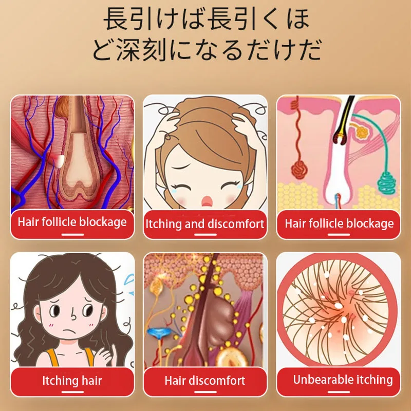 Crème de soin de santé pour follicules pileux, dommages aux follicules pileux, huile pour tête bouchée, démangeaisons et inconfort, crème d'application pour soins externes