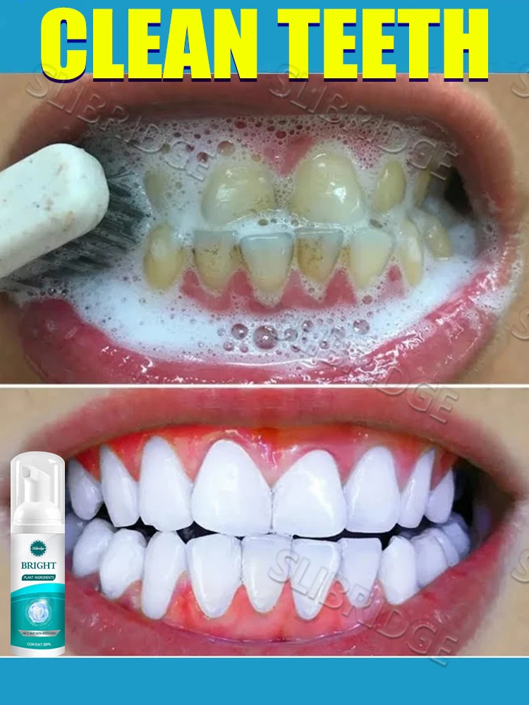 

Free shipping,Teeth cleaning care tools, oral foam,Free shipping