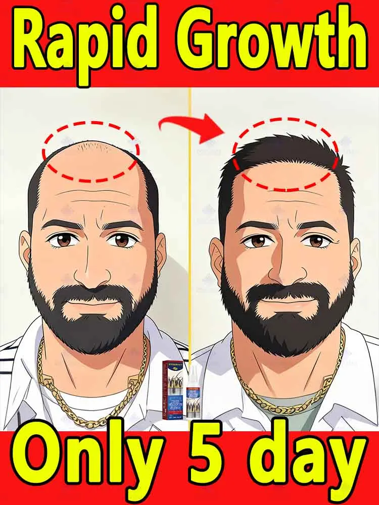 

Ежедневный спрей для кожи головы, значительно уменьшающий выпадение волос при расчесывании.