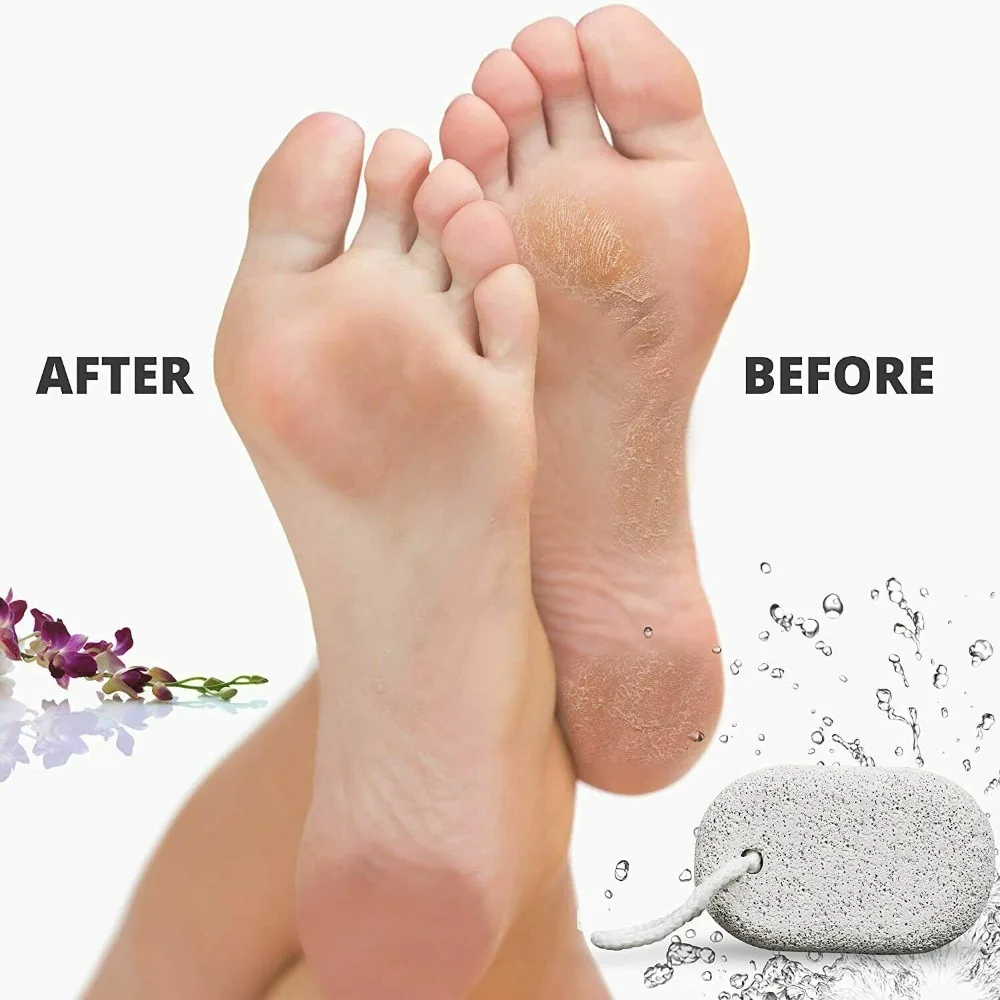 Hard Natural pomice Stone Feet strumento di esfoliazione ellittica accessori Scrubber per piedi spazzola per Pedicure per pelle morta