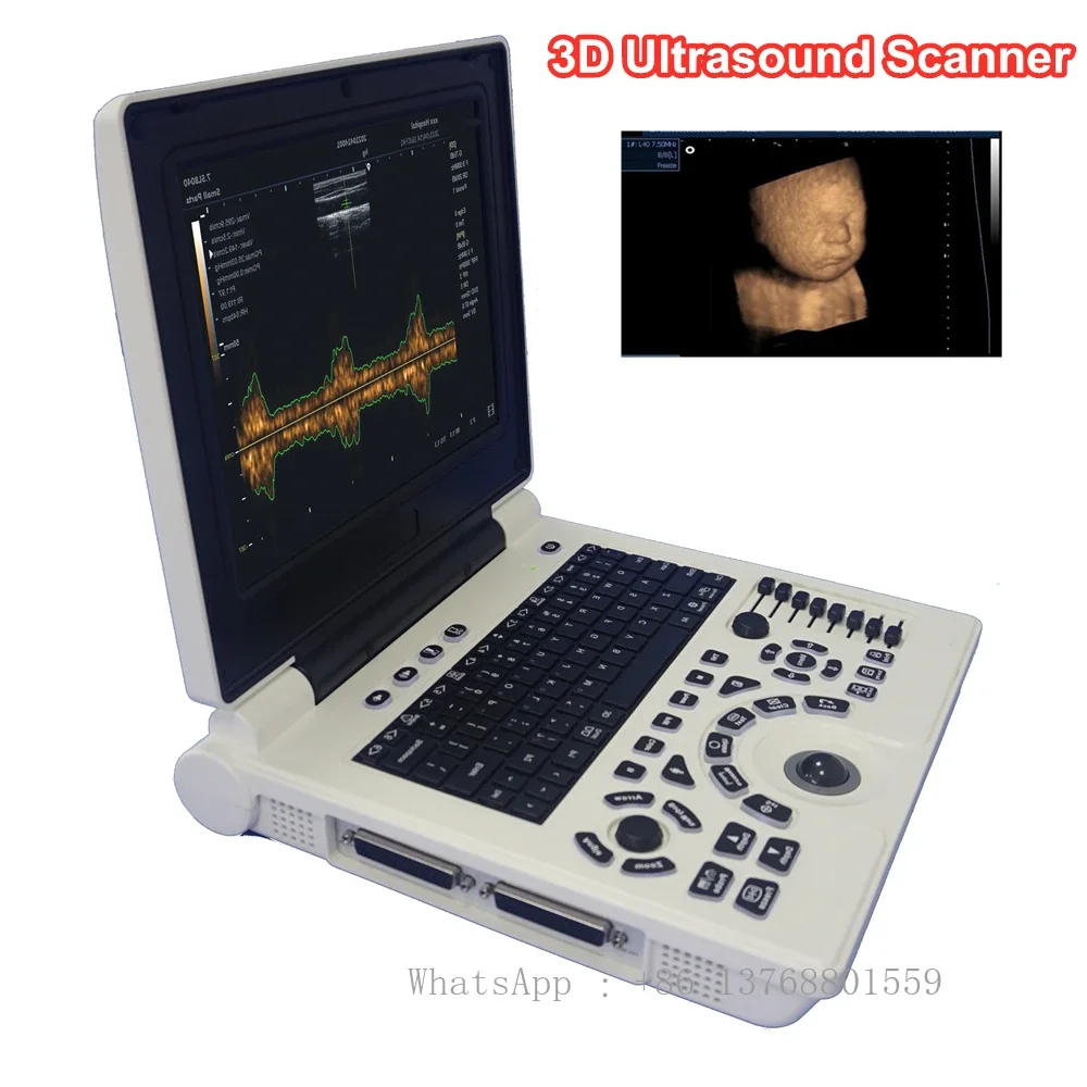 12inch Led PW 3D Image Notebook Ultrasound Scanner Echo Machine PC Based Li-battery