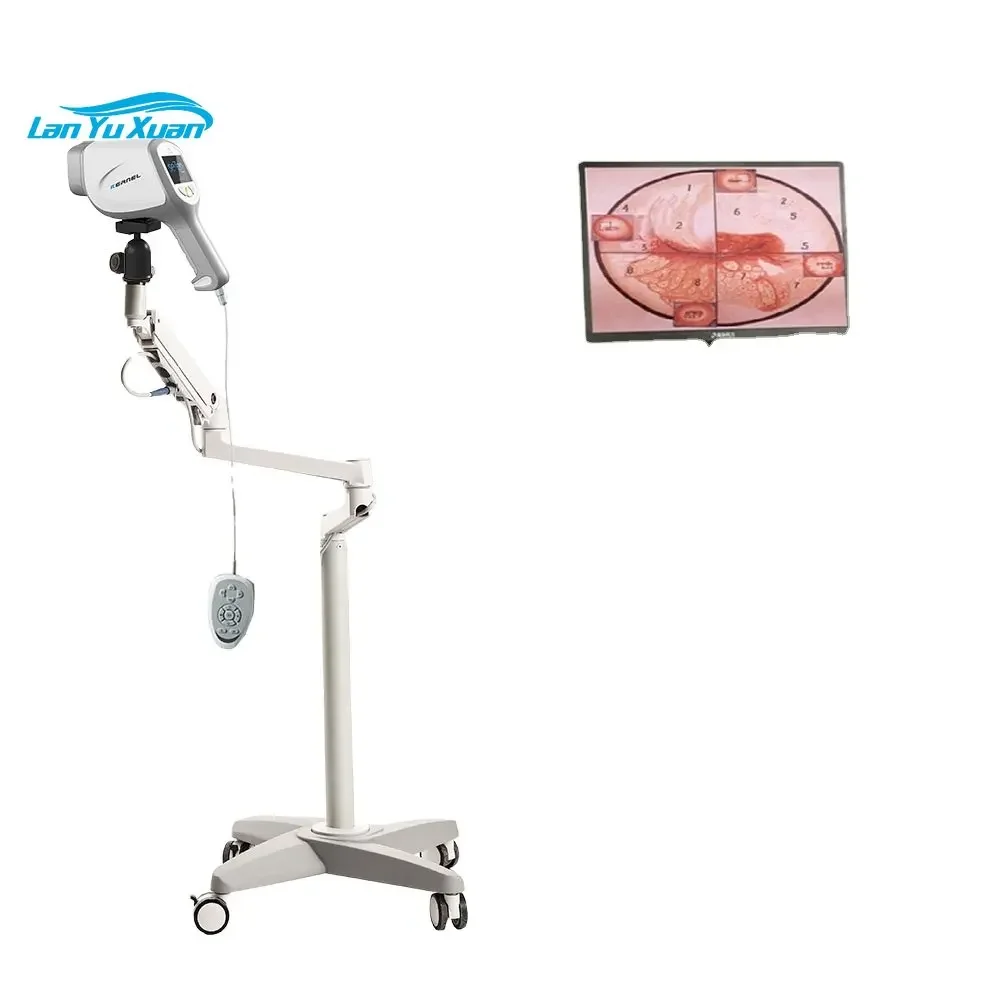 Digital Electronic Video Colposcopy for Gynecology/Portable  Gynecological Colposcopy Machine for Woman kernel kn2200