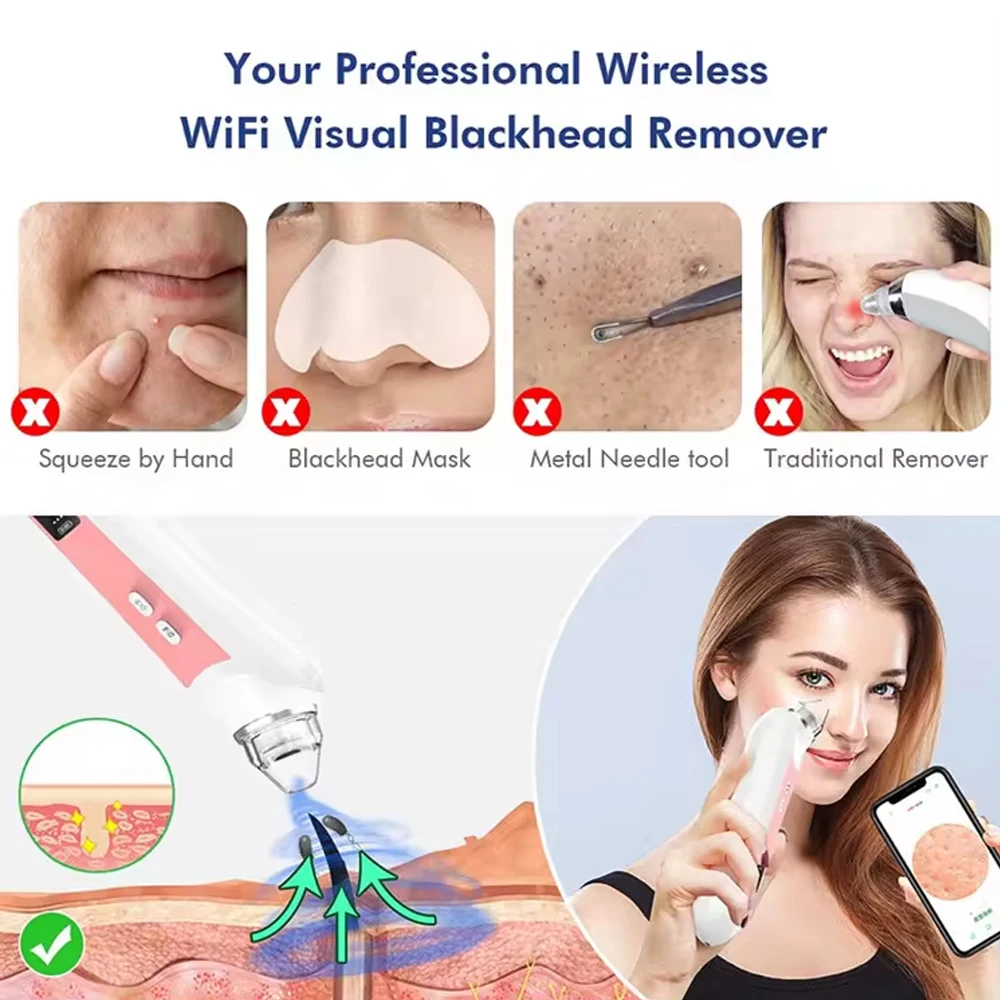 6 Heads Pore Cleaner Blackhead Remover Vacuum with Camera Face Acne Pimple Extractor Facial Nose Skin Care Tools