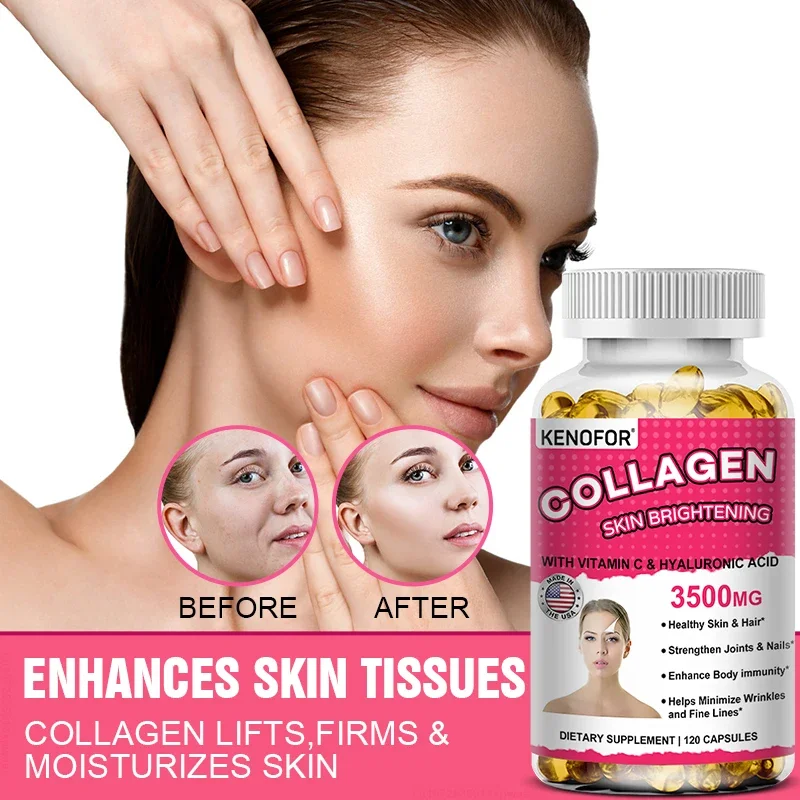 Super Collagen with Vitamin C and Hyaluronic Acid, Skin, Hair, Joints and Nails Supplement with Antioxidants, Anti-Aging