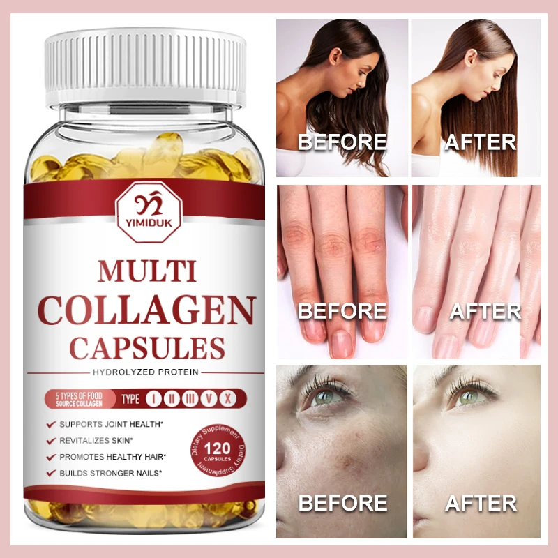 Collagen Capsules - Anti-Aging, Healthy Joints, Hair, Skin, Bones, Nails, Hydrolyzed Collagen Peptides, for Men & Women