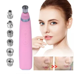 Alwafore Diamond Microdermabrasion Machine Blackhead Remover Pore Vacuum Advanced Facial Treatment Device