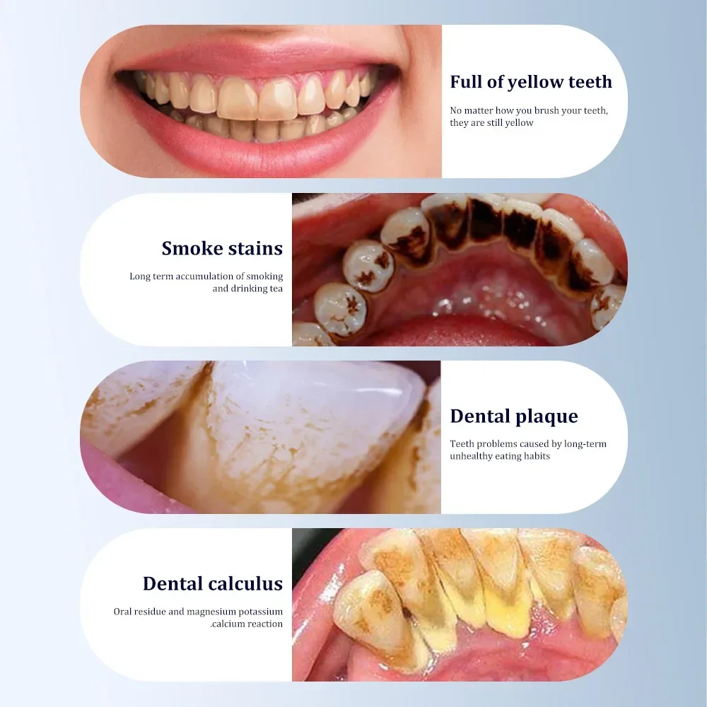 3 em 1 raspador dental elétrico escova de dentes elétrica portátil cuidados orais removedor tártaro placa limpador ultrassônico kit clareamento dos dentes