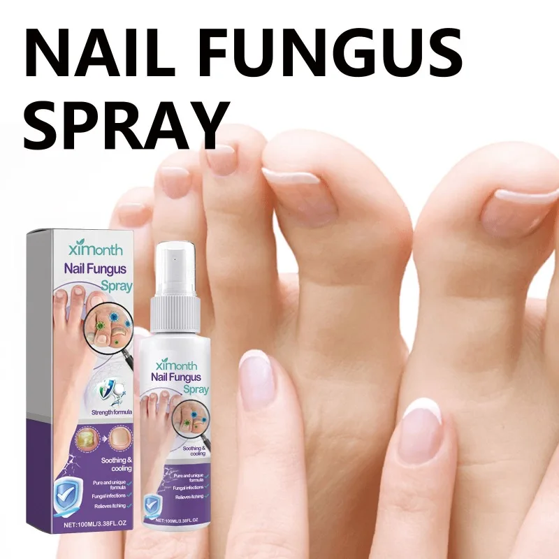 Nail Fungus Spray Reduce Beriberi Deodorize Remove Onychomycosis Paronychia Deeply Mild Cleansing Smoothing Nail Care Spray