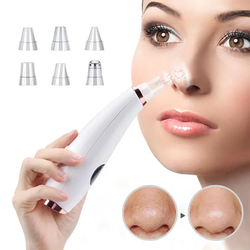 Aspirateur électrique pour points noirs, nettoyeur d'acné, élimination des taches noires, nettoyage en profondeur du visage, Machine de nettoyage des pores, outils de soins de la peau