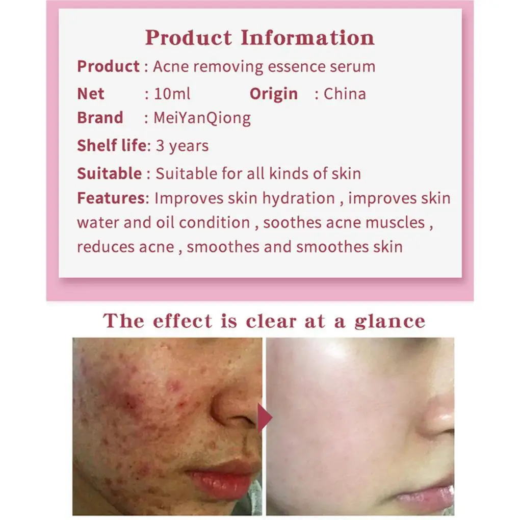 10ml Centella Asiatica Acne Essence Hydrating Anti-Inflammatory Control Oil Pimples Removal Liquid Essence