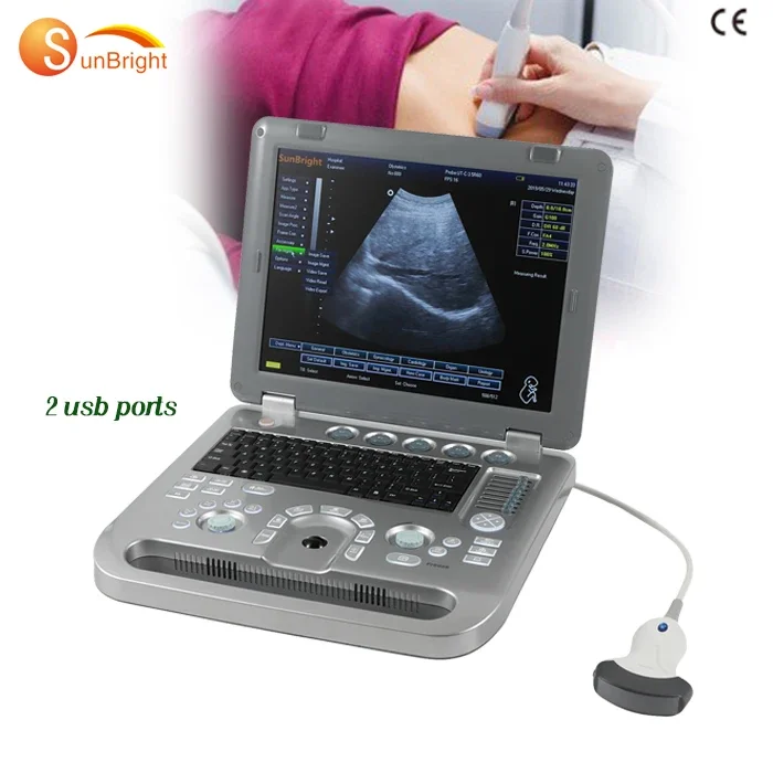 

CE Portable digital Doppler ultrasound system ecografo devices SUN-800D