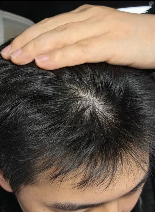 Customer review photo