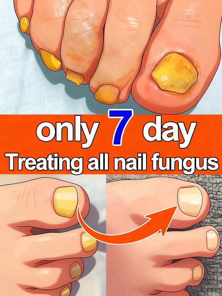 

manicure for bad Can in 7 days farewell Cleaning Nail Repair Pedicure Package Tools