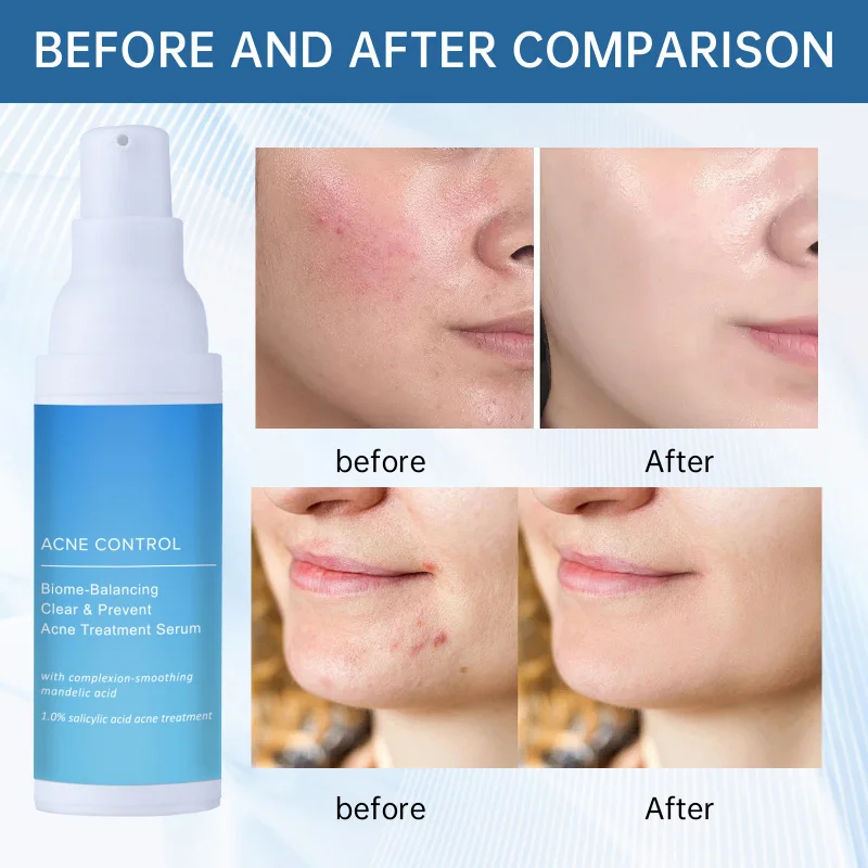 

Exfoliating Moisturizing Serum Hydrating Solution Removes Dead Skin, Replenishes Moisture and Softens Stubborn Dry Skin