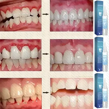 10 best sales 치클리트 - №9