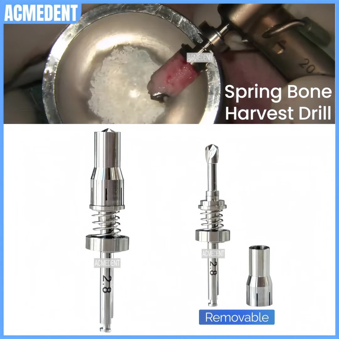 

⌀ 2.8 Стоматологическая GBR пружинная дрель для урожая костей Самошлифовальная дрель с автоматическим коллектором костей