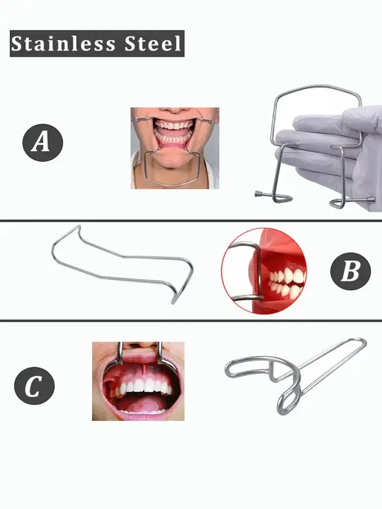 Écarteur dentaire de joues et de lèvres en acier inoxydable de haute qualité, outil d'ouverture de bouche pour procédures orthodontiques
