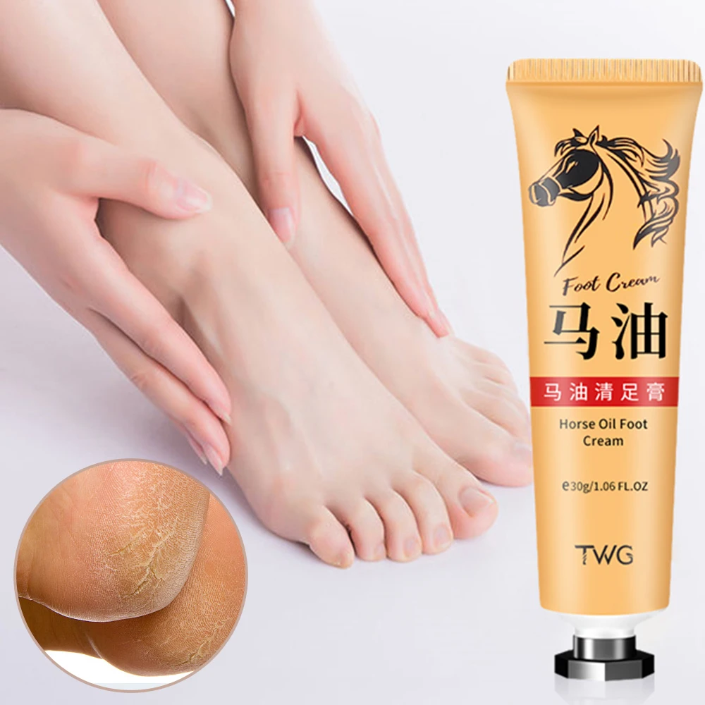 Anti Crack Foot Cream tallone riparazione screpolata crema all'olio di cavallo rimozione liscia pelle morta callo Anti-essiccazione piedi per le mani cura della pelle 30g