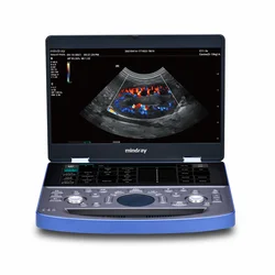 Mindray Veterinary  Ultrasound Vetus E7 Hand-Carried Veterinary Ultrasound System