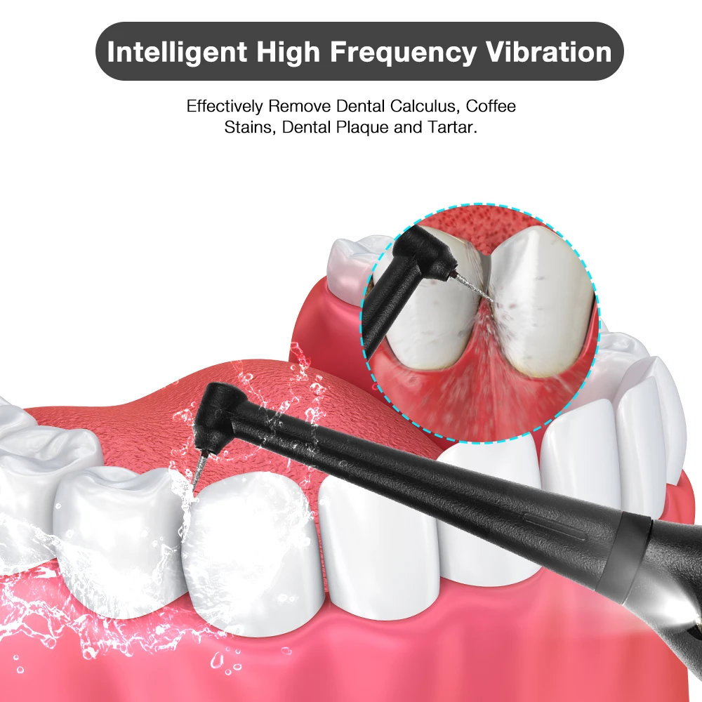 Electric Ultrasonic Dental Scaler 5 Modes Calculus Oral Tartar Remover Tooth Stain 9 Levels Cleaner Teeth Whitening Oral Care image 2
