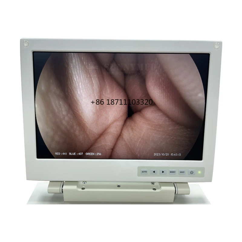 SY-P033-1 All in One Video Veterinary Colonoscope Gastroscope Price For Sale