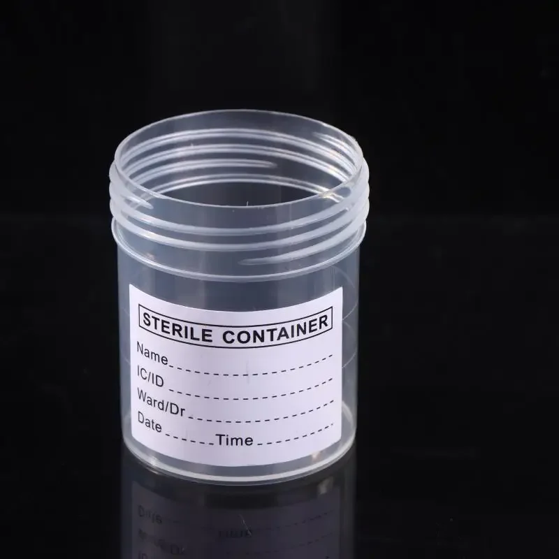 10 Uds. Contenedor de vaso de plástico de 60ML, recipiente desechable para colección de orina, recipiente para botella de muestra con etiquetas