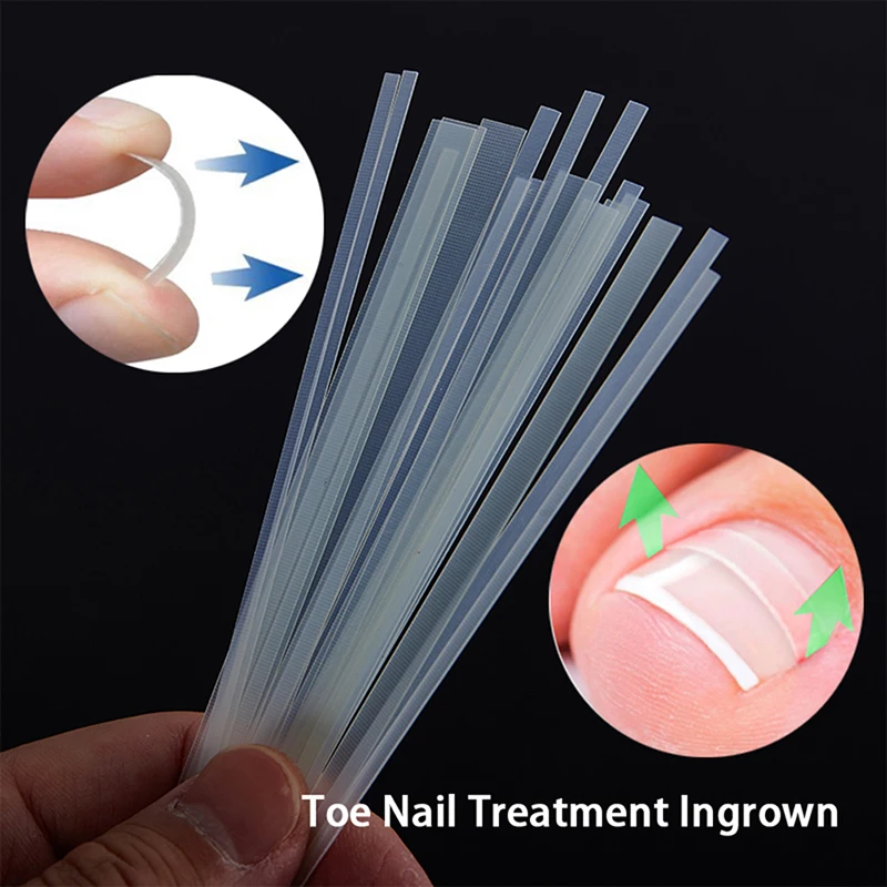 5 Stuks Ingegroeide Teen Nagel Behandeling Ingegroeide Teennagel Correctie Tool Elastische Patch Sticker Rechttrekken Clip Brace Pedicure Tools