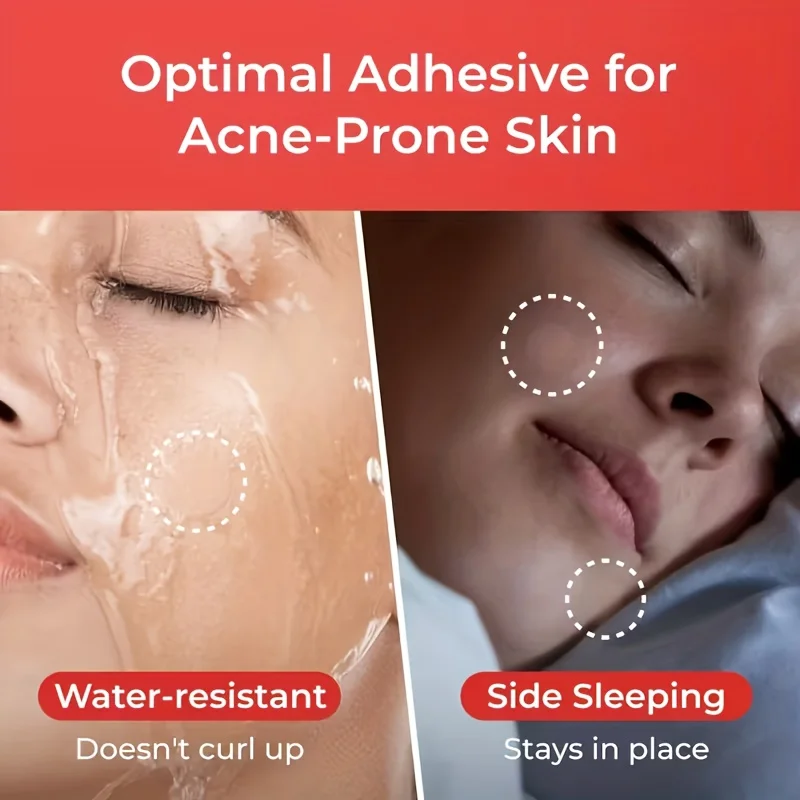 372PCS Hydrocolloid Acne Patch | Perfect for covering acne and blemishes |Comes with 10PCS cleansing cotton swabs |Deeply cleans