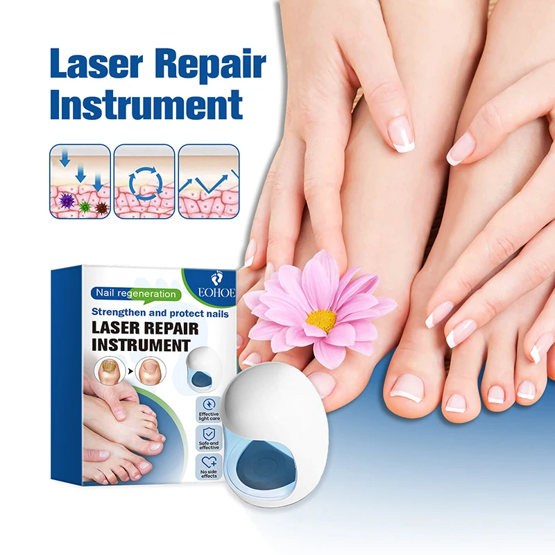 Fungal Toe Nail Device Repair Fast Toenail Nails Fungus Onychomycosis Repair Toenail Fingernail Removes Nail Fungus Treatment