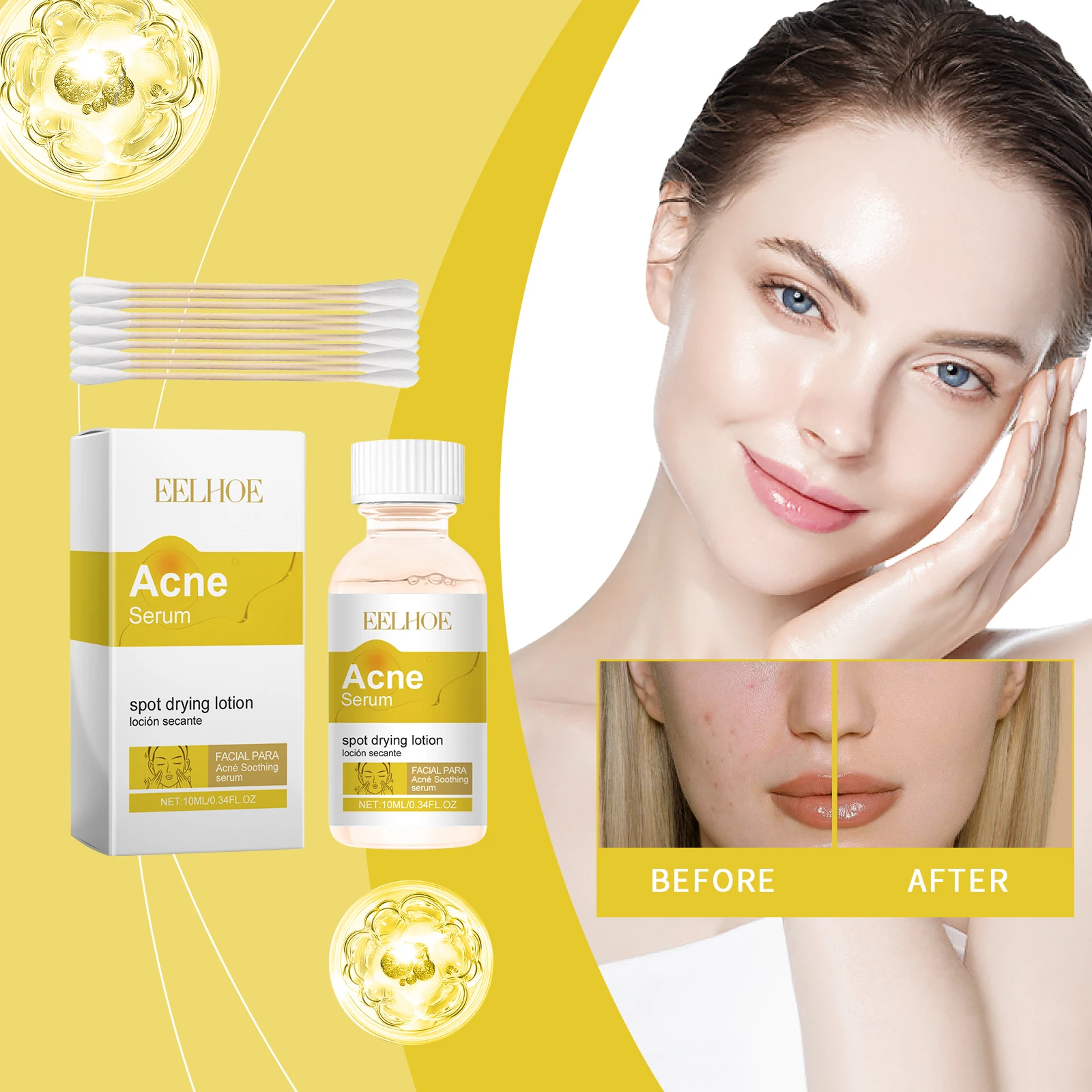

EELHOE Facial Flat Pox Essence улучшает застежку от мышц прыщей, регулирует секрецию кожного сала и нежирную кожу.