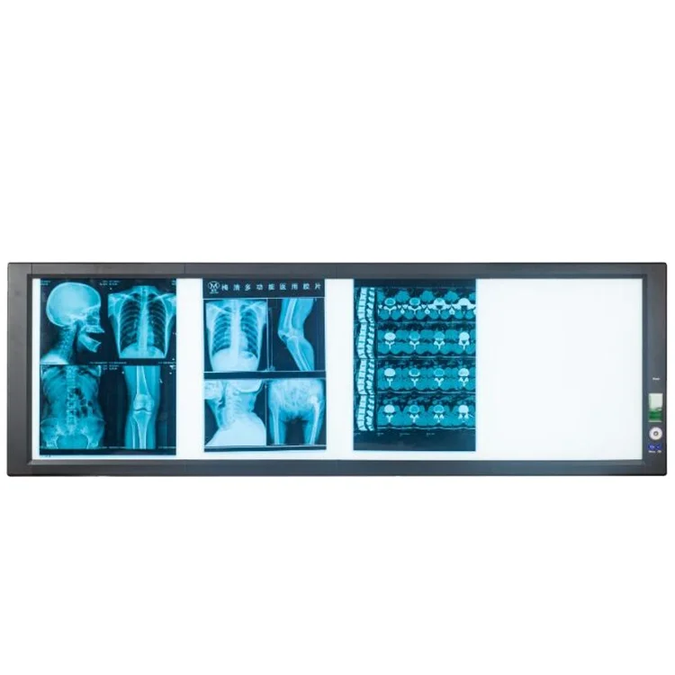 MT Medical Ultra Thin View  Led X Ray Film Medical Union Hospital Scanner Box Negatoscope Four Panel X-Ray Film Viewer