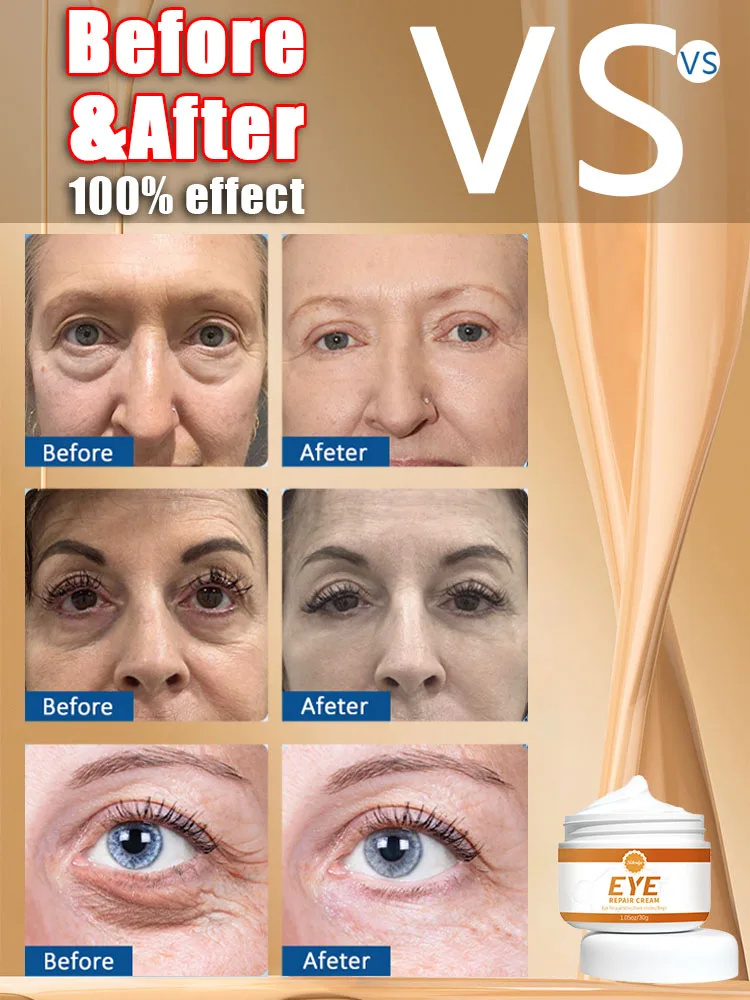 

Visibly Reduce under eye bags, reduces fine wrinkles, Mejora skin Elasticidad, Reduced dark circles, Ilumina the eye ar