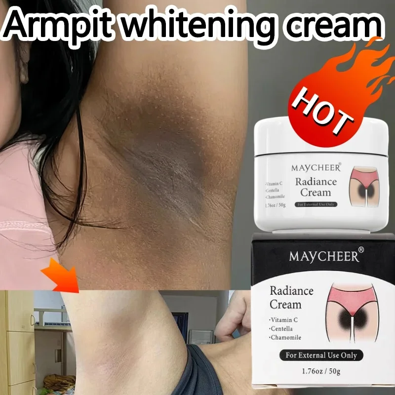 Inner Thigh Brighten Cream Bleaching Armpits Elbows Knees Moisturize Body Lotion Cream Brighten Lighten Whiten Melanin Skin Care