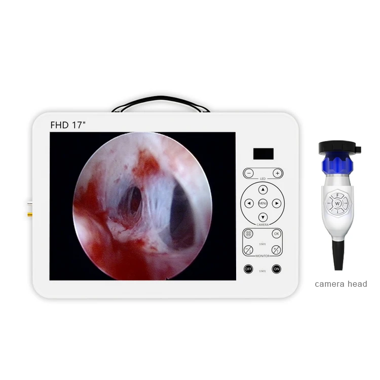 small medical endoscope  full hd portable office hysteroscopy