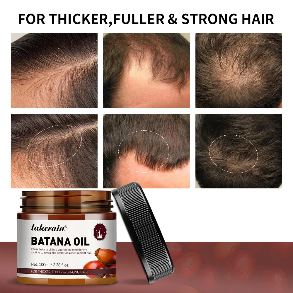 Batana Oil Hair Growth Enhance Efficacy Add Moisture Nutrition To The Hair Strengthen The Hair's Tensile for Thicker Strength