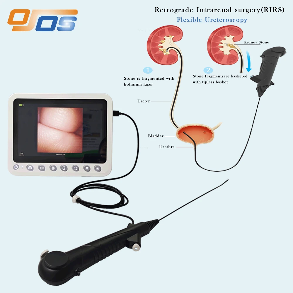 OD 6.3FR ID 1.1mm Flexible Ultra-Fine Uretreroscope with 400*400 Pixel for Veterinary Market