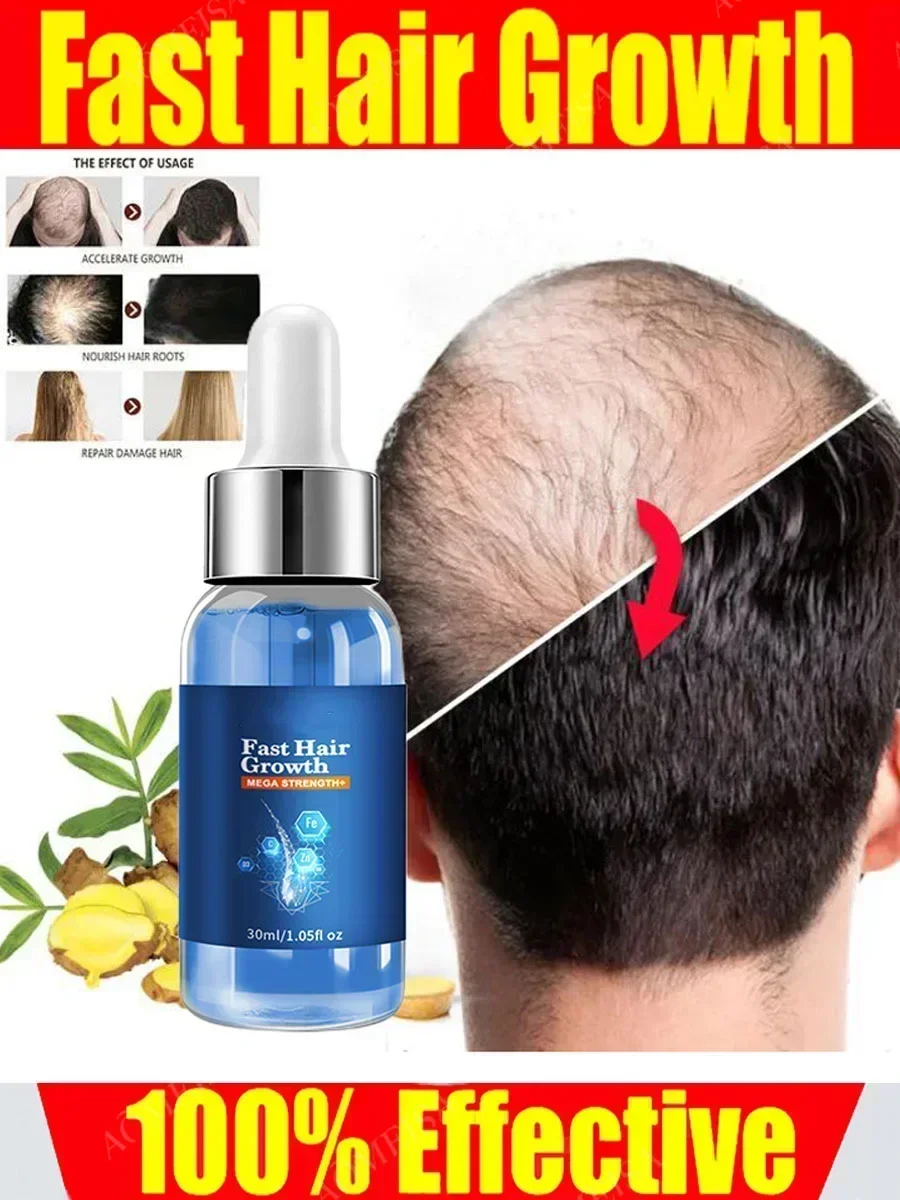 

Fast Hair Growth Oil Effective Baldness Repair Hereditary Hair Loss Postpartum Hair Loss Seborrheic