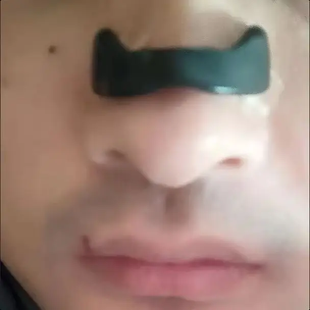 

Rod-shaped nasal strips for snoring-comfortable all-night sleep, non-invasive sleep aid