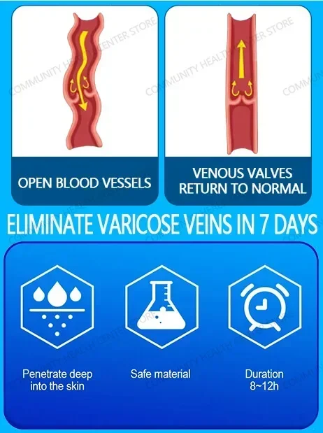 Laser vein