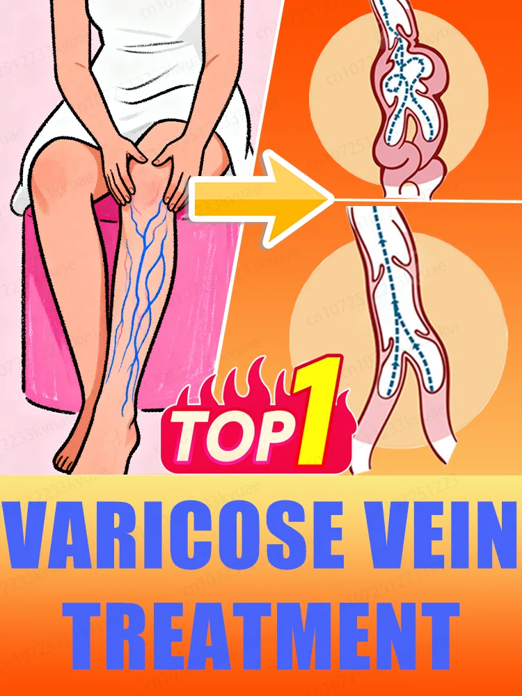 

Leg vein repair light, leg vein patch, deformed and damaged, body care, 2025