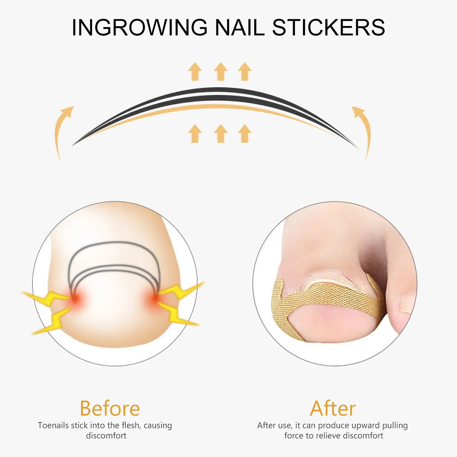 

1Set Toenail Orthopaedic Stickers Ingrowing Nail Foot Nail Repair Tools Toenail Recovery Patches Toenails
