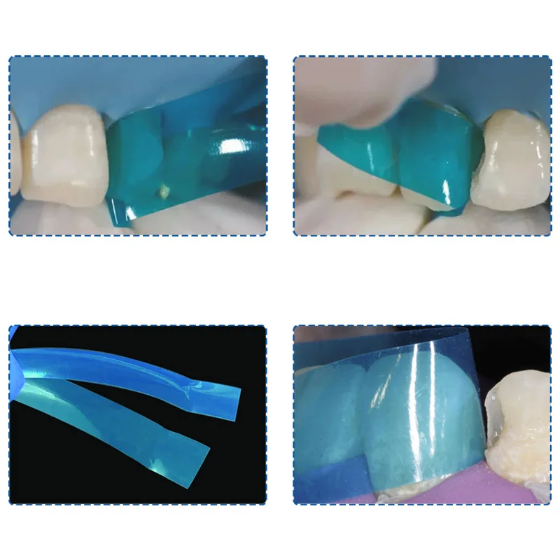 Dental Contoured Anterior Matrix 0.05mm Blue Transparent Resin Matrix Strip Sectional Contoured Matrix System Anterior Matrices