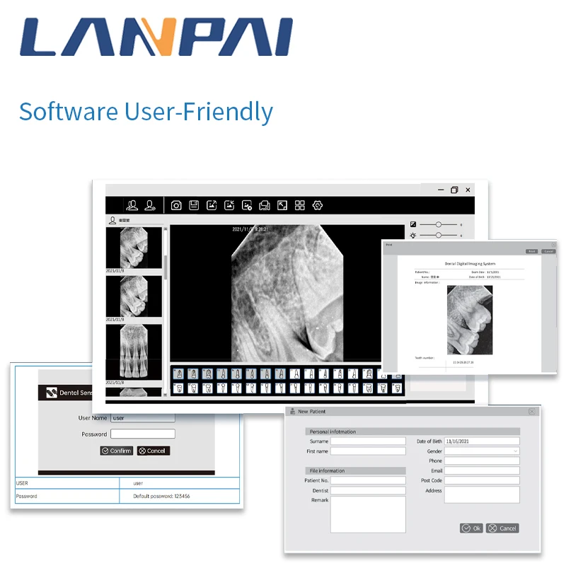 Lanpai Dental X-Ray Sensor Rvg Rx Digital Sensor With 13 Language Dentistry Equipment