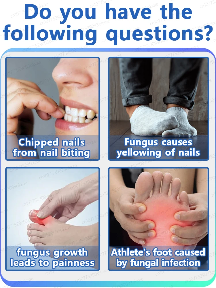 Professional nail fungus care: deep penetration of the nail plate to target and eliminate stubborn fungi.
